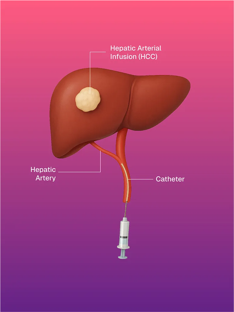 USG ve CT Kılavuzlu FNAC/BİYOPSİ