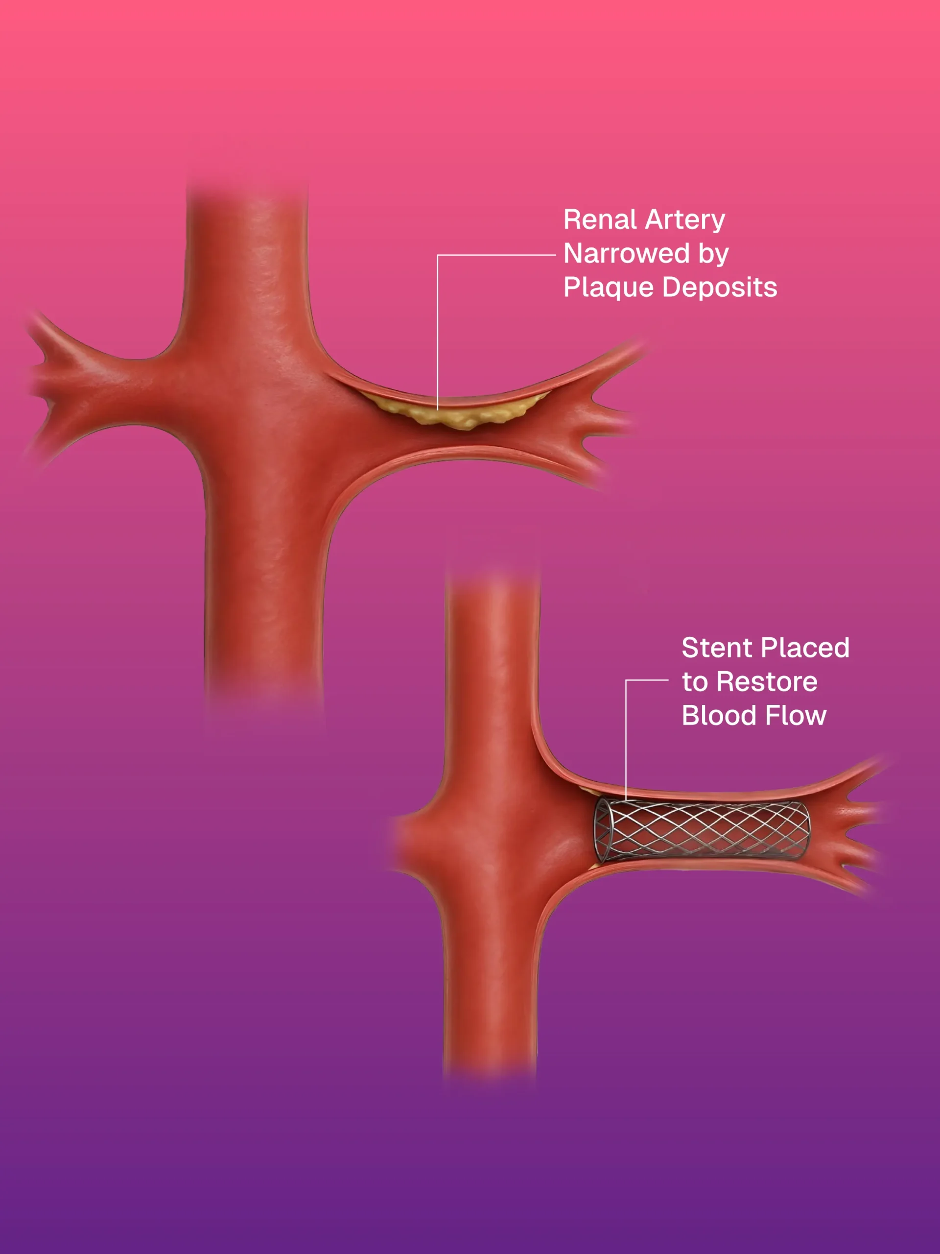 USG ve CT Kılavuzlu FNAC/BİYOPSİ