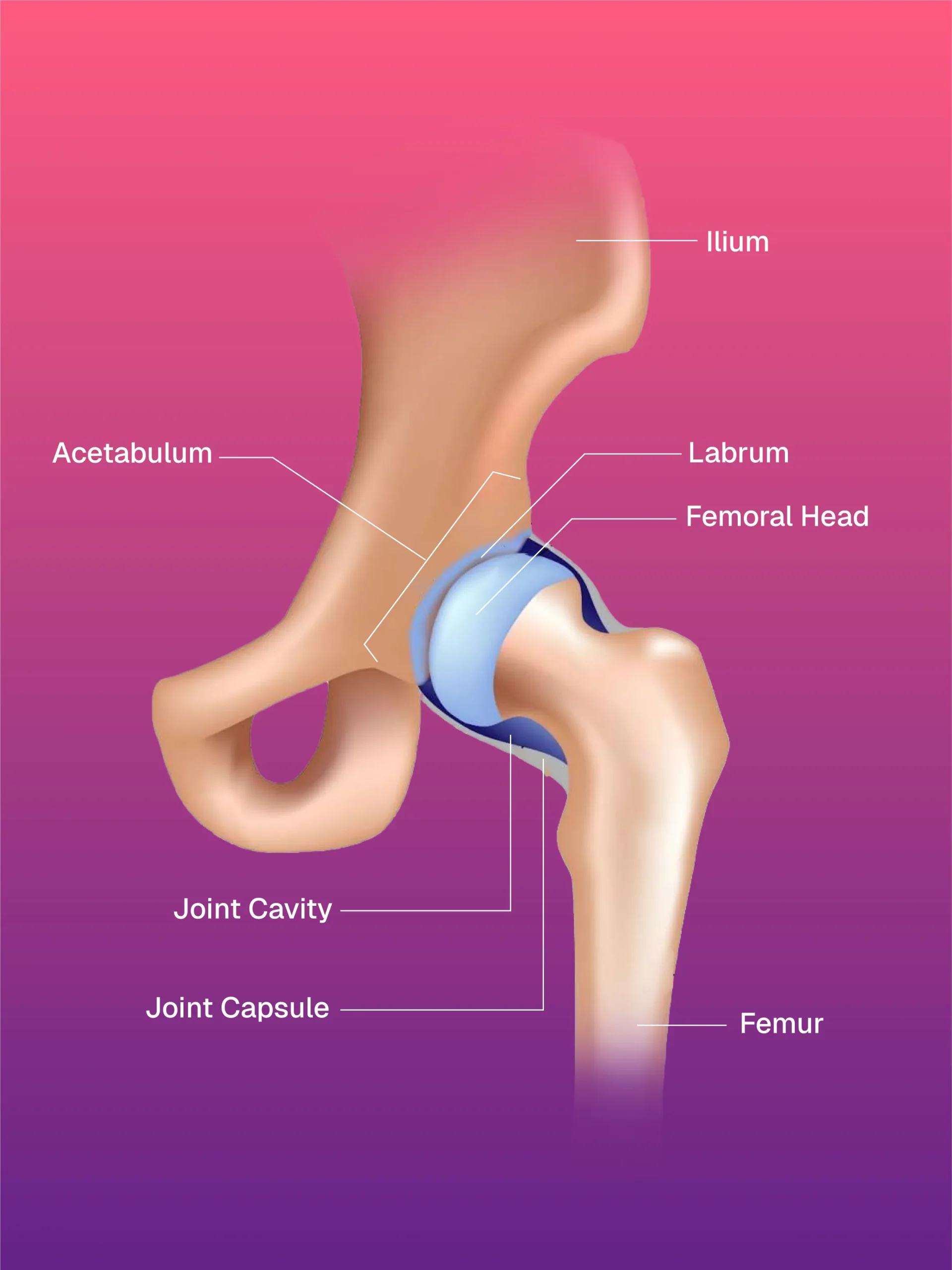 Santral Hat / Kateter