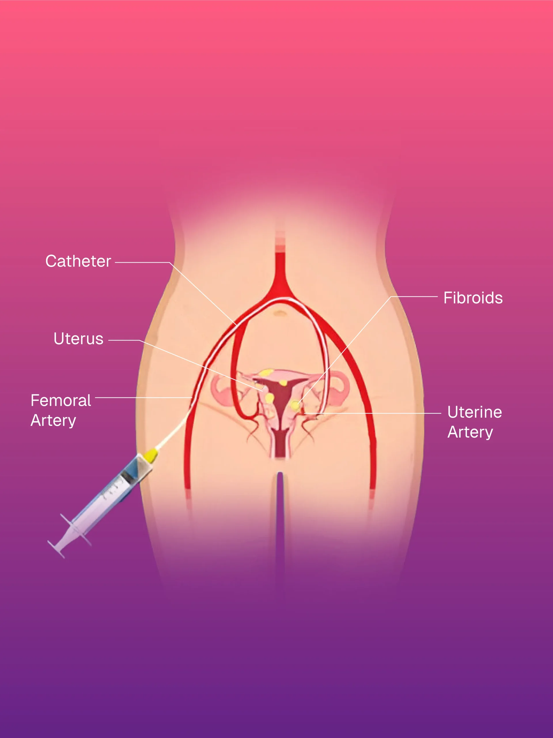 USG ve CT Kılavuzlu FNAC/BİYOPSİ
