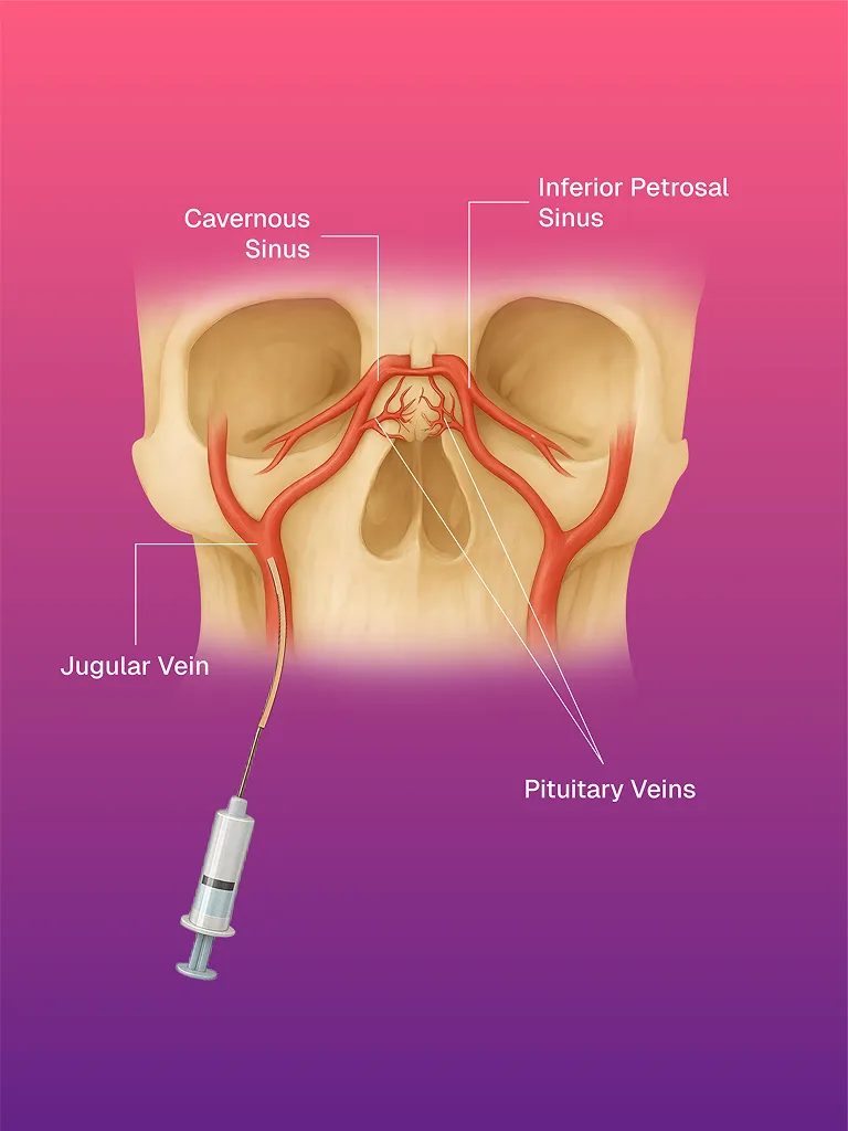 Santral Hat / Kateter