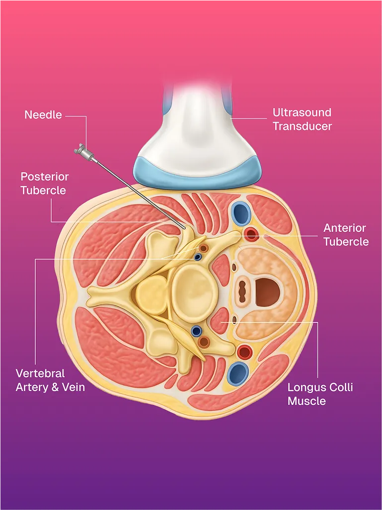 Vakum Destekli Meme Biyopsisi
